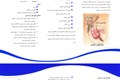 آپاندیس