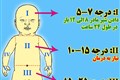 زردی نوزاد